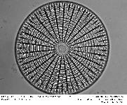 Arachnoidiscus ehrenbergi Bailey=Arachnoidiscus ornatus Ehr