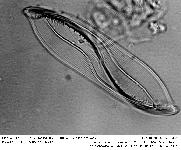 TROPIDONEIS VITREA