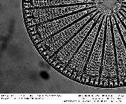 ARACHNOIDISCUS EHRENBERGII Bailey