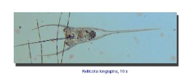 Kellicottia longispina