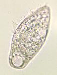 Blepharisma lateritia