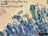 Cantharellus cibarius E.M. Fries : coupe, baside et spore