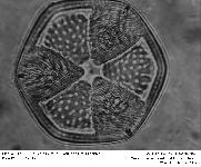 Actinoptychus hexagonus Grunow