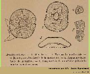 Arcella artocrea Leidy, 1876