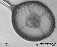 Axoprunum monostylum Caulet 1986