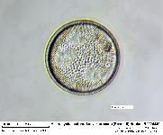 Actinocyclus octonarius var. crassus