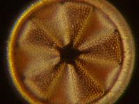Actinoptychus heliopelta (Brun) Haeckel