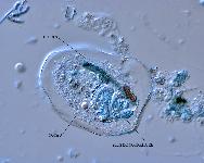 Amoeba terricola (ou verrucosa)