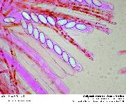 Cheilymenia stercorea (Pers.) Boud.